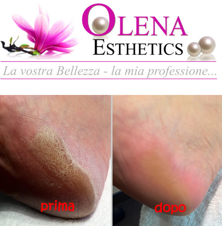 Pedicure per piedi lisci come seta con mavex calluspeeling