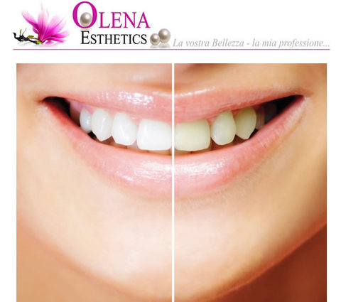 Sbiancamento denti professionale ed efficace